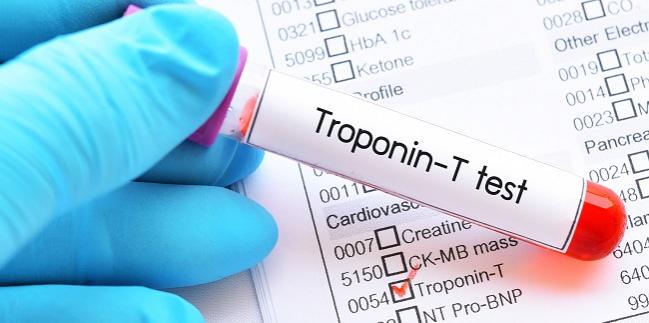 TROPONIN T