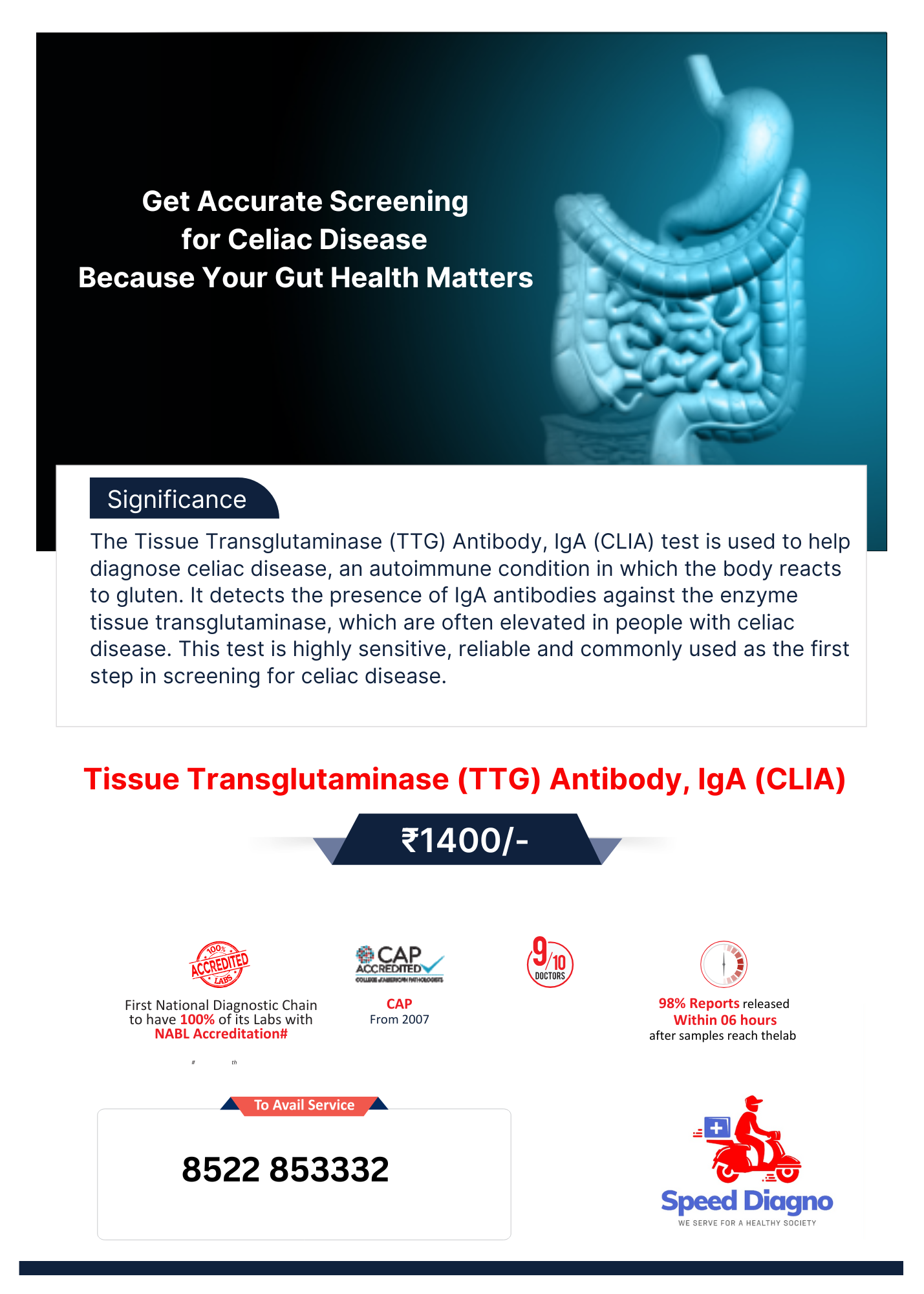 Tissue Transglutaminase (TTG) Antibody, IgA (CLIA)