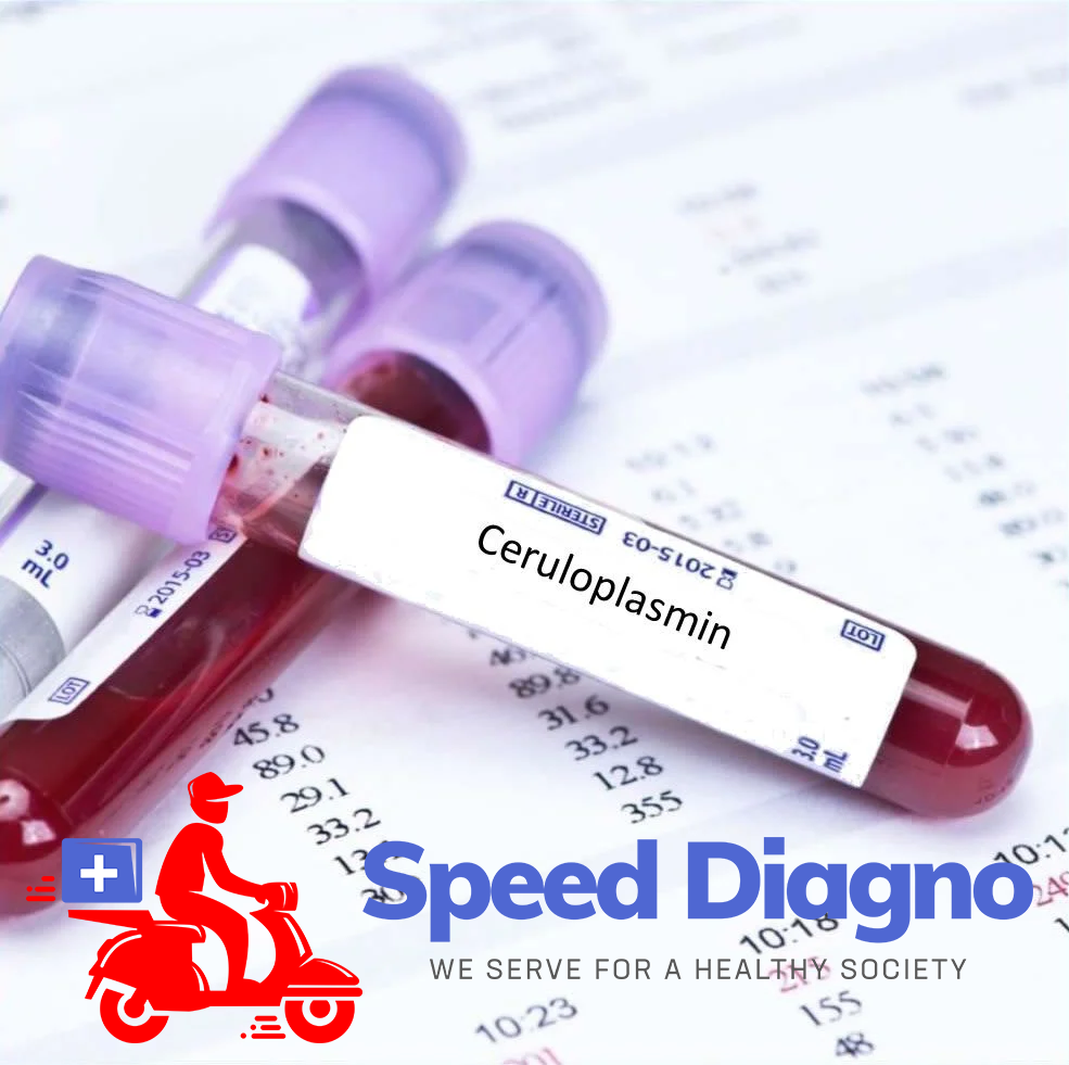 CERULOPLASMIN