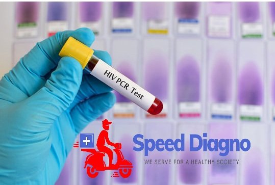 HIV 1-DNA PCR - Qualitative