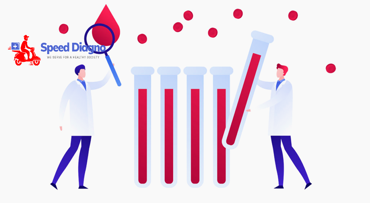 PERIPHERAL SMEAR STUDY