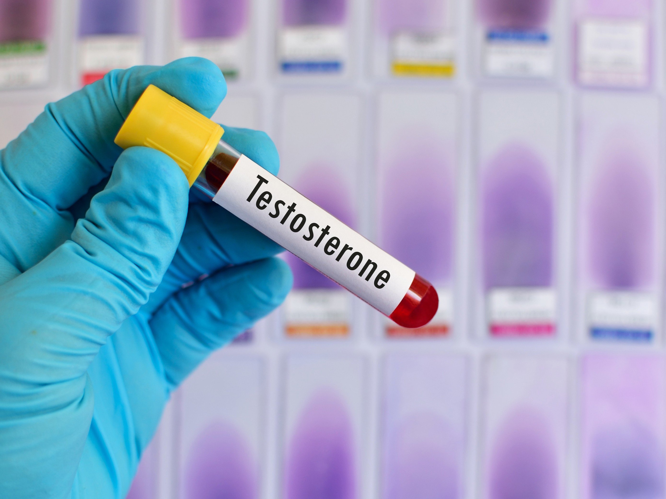 TESTOSTERONE ( TOTAL)