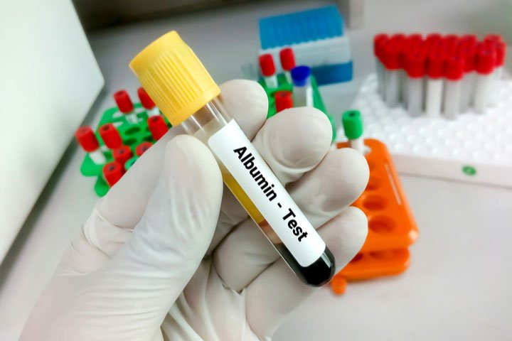 Albumin