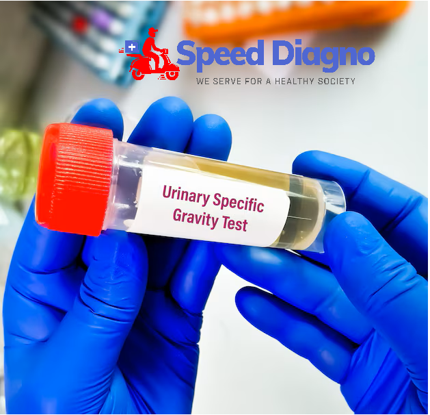 SPECIFIC GRAVITY