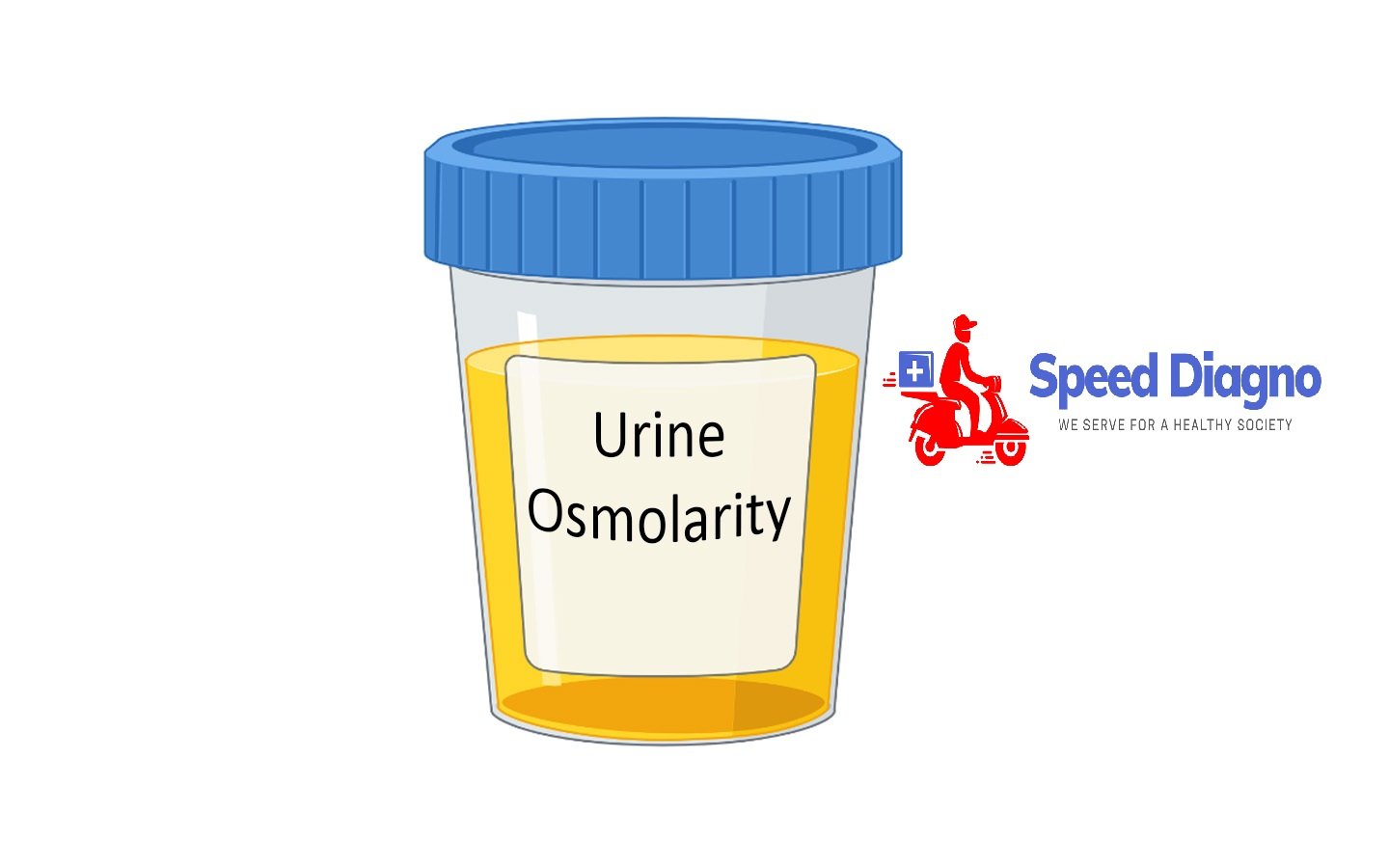 Urine Osmolality