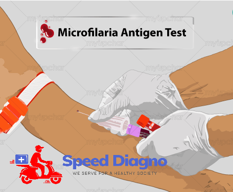 MICROFILARIA (MF)