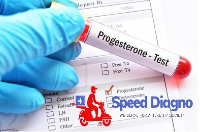 PROGESTERONE