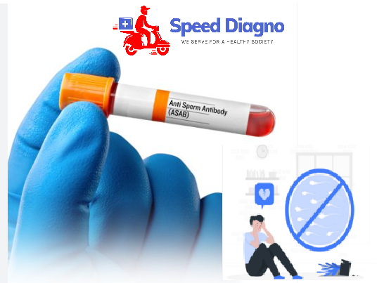 Anti Sperm Antibody