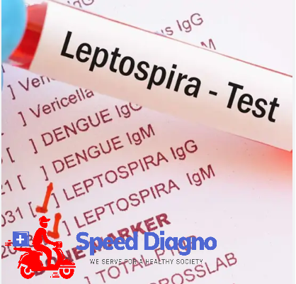 LEPTOSPIRA ANTIBODY IGM & IGG