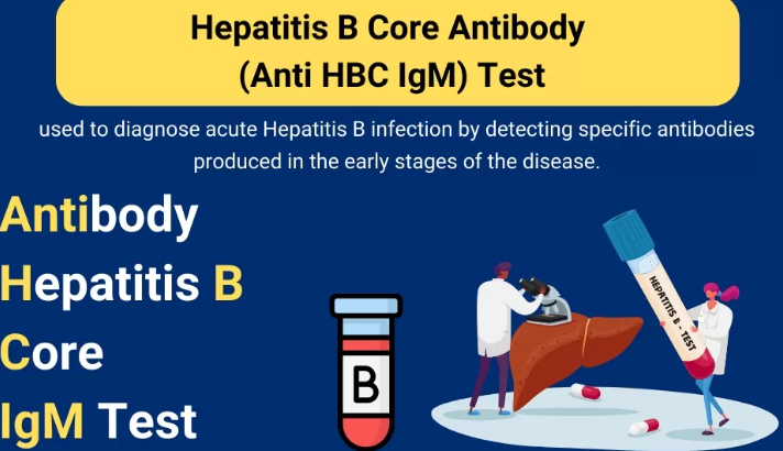 Hepatitis Core Antibody IgM (Anti HBc - IgM)