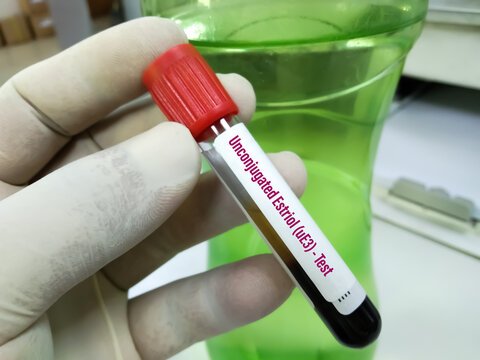ESTRIOL UNCONJUGATED (UE3), SERUM