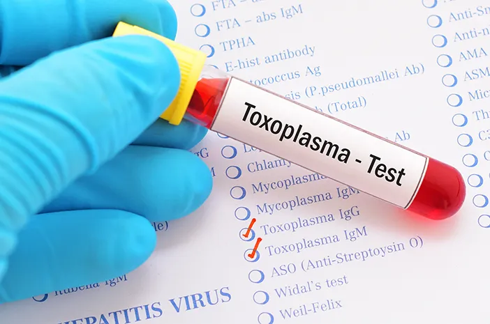 Toxoplasma-IgM