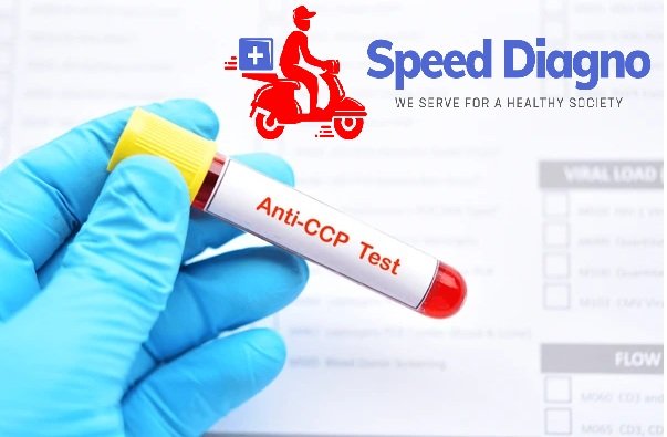 Anti Cyclic Citrullinated Peptide Antibody (CCP)