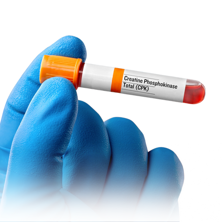 Creatinine Phosphokinase - CPK NAC