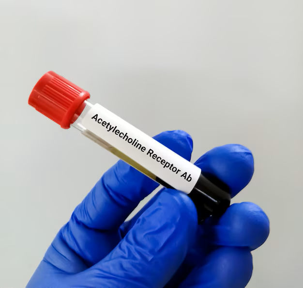 ACYTYL COLINE RECEPTOR ANTIBODY
