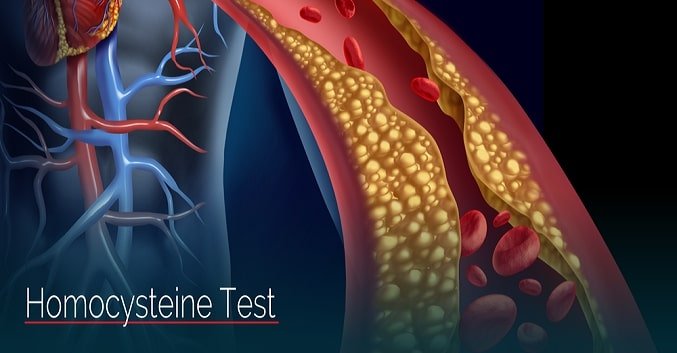 HOMOCYSTEINE