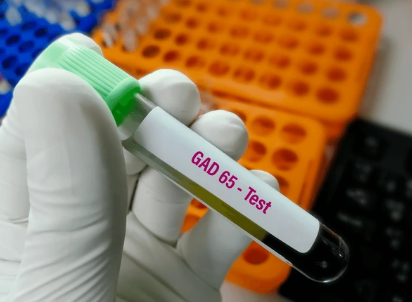 GAD-65 (GLUTAMIC ACID DECARBOXYLASE- 65)