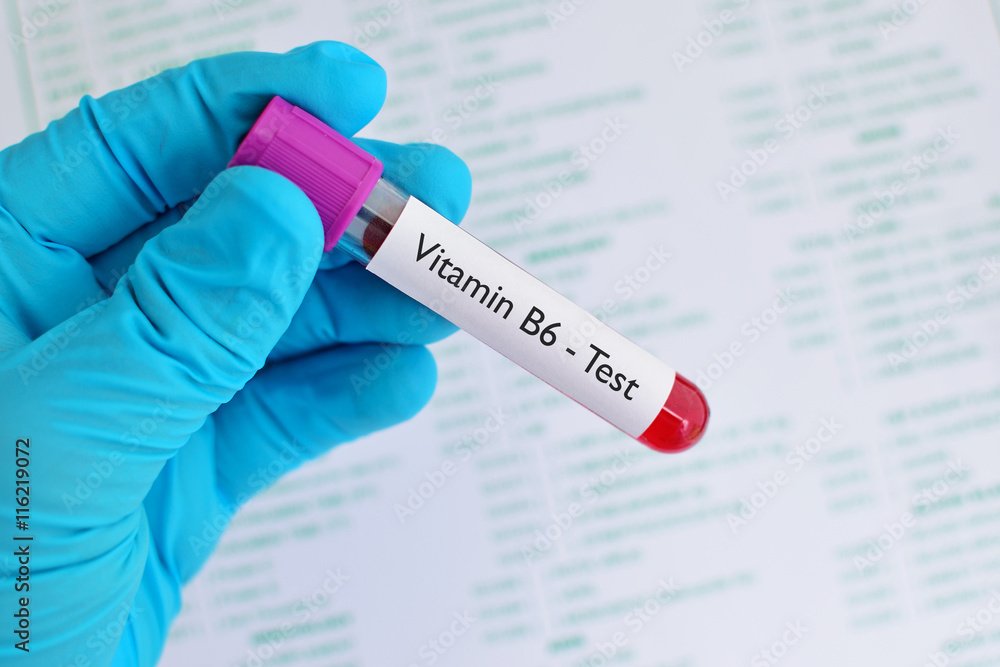 VITAMIN B6