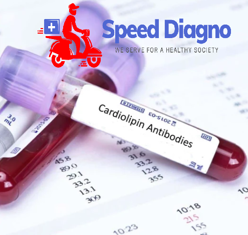 Anti Cardiolipin Antibody IgM