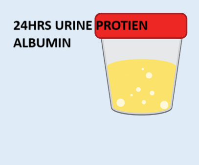 24 HRS URINARY ALBUMIN