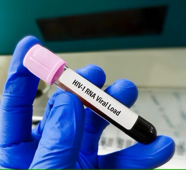 HIV I& II