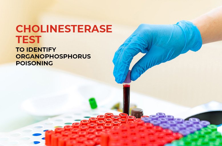 CHOLINESTERASE