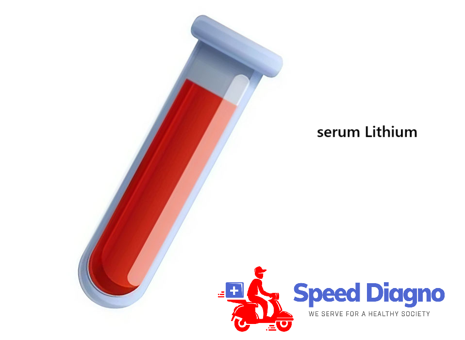 LITHIUM LEVEL