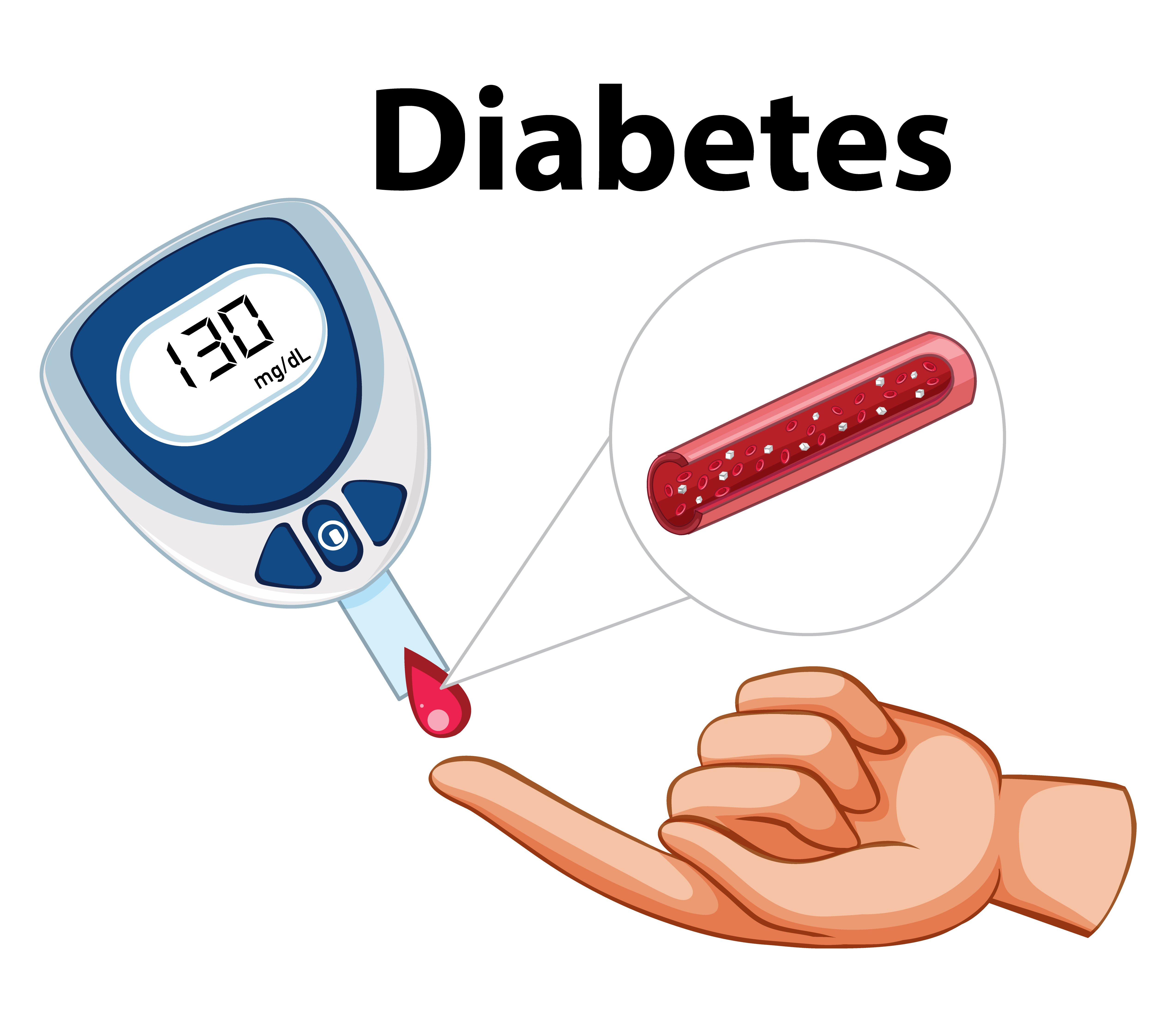 RANDOM BLOOD SUGAR (RBS)