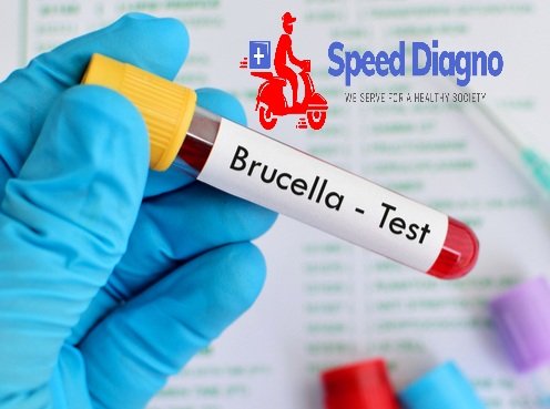 BRUCELLA ANTIBODY IgM