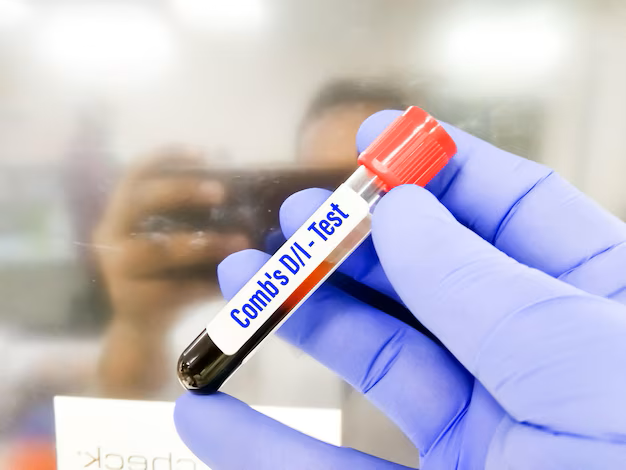 INDIRECT COOMBS TEST ( ICT )
