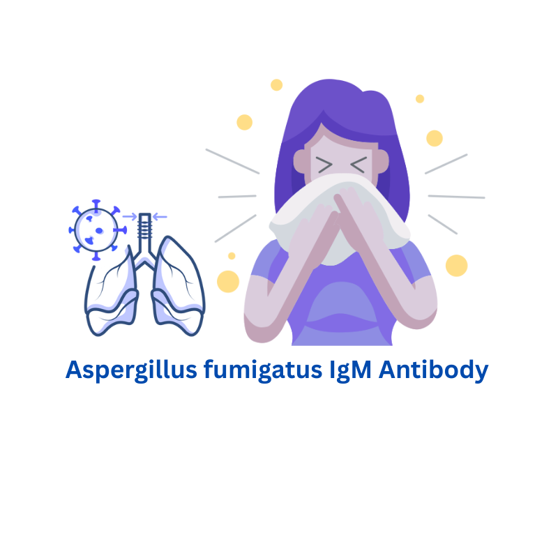 Aspergillus fumigatus IgM Antibody